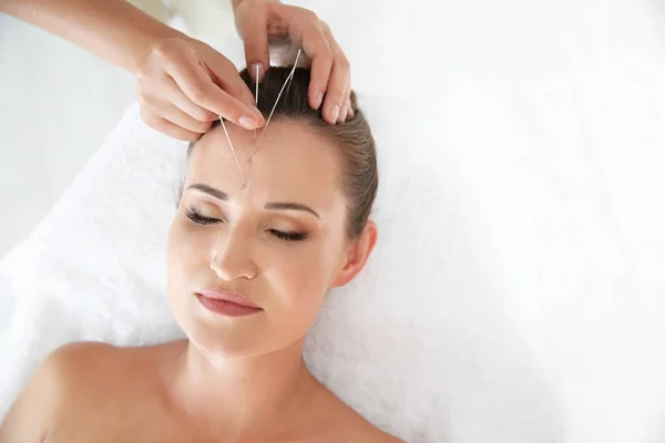 Young woman undergoing acupuncture treatment in salon