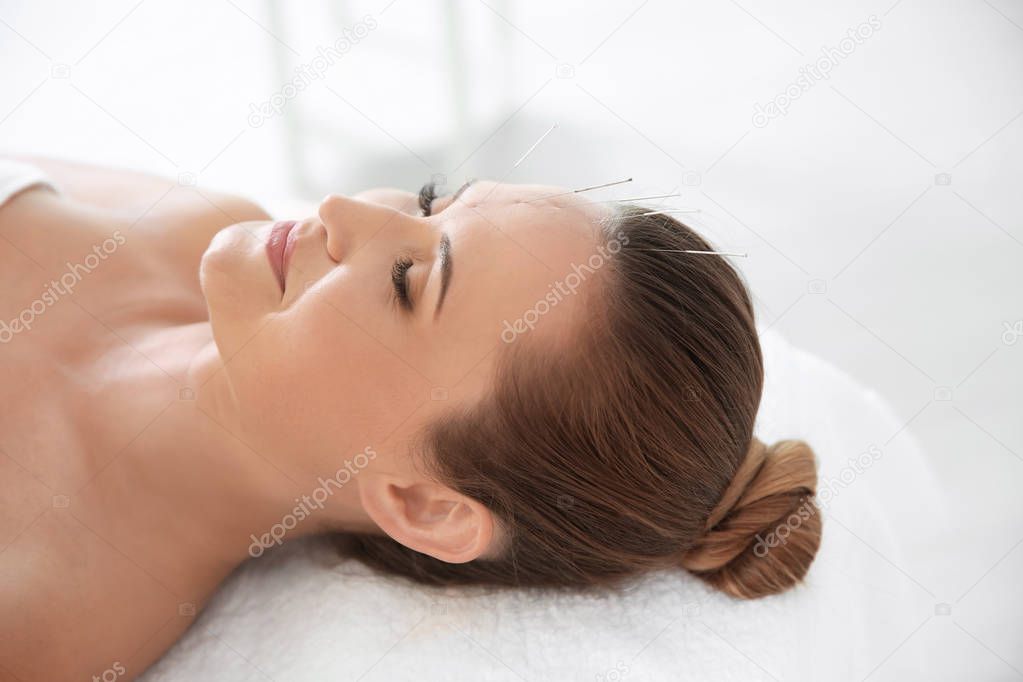 Young woman undergoing acupuncture treatment in salon