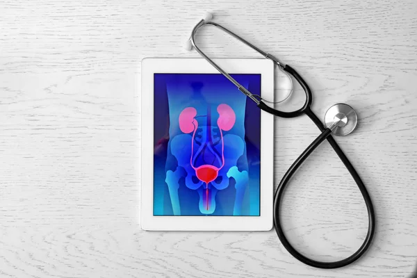 Tabletti Jossa Virtsajärjestelmä Stetoskooppi Puupohjalla Urologian Käsite — kuvapankkivalokuva