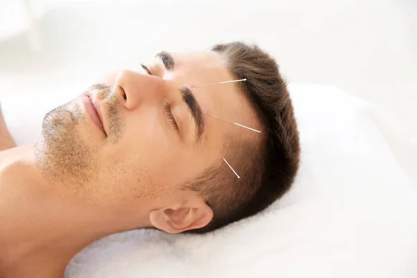 Young Man Undergoing Acupuncture Treatment Salon — Stock Photo, Image