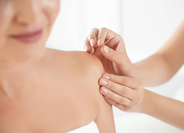Salonda Closeup Akupunktur Tedavisi Gören Genç Kadın — Stok fotoğraf
