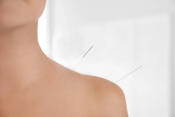 Jonge Vrouw Die Een Acupunctuur Behandeling Salon Close — Stockfoto