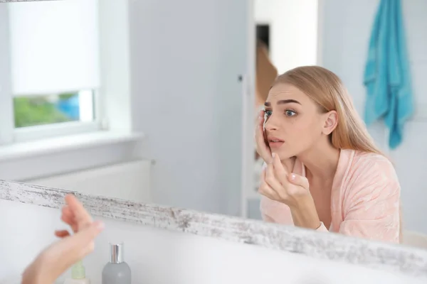 Young Woman Eyelash Loss Problem Looking Mirror Indoors — Stock Photo, Image