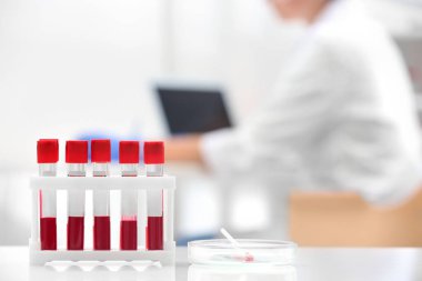 Kan örnekleri ve bilgisayar laboratuarında çalışan bilim adamı ile test tüpleri