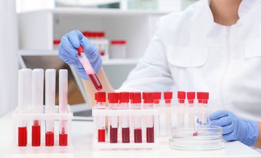 Kan örnekleri test tüpleri ile masada çalışan bilim adamı