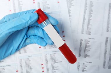 Cam tüp kan örneği ile belgelere, closeup tutan doktor. Alerji testi