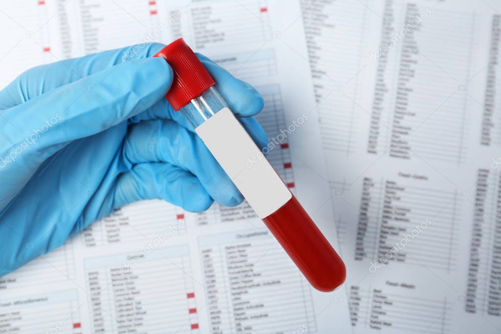 Doctor holding glass tube with blood sample over documents, closeup. Allergy test