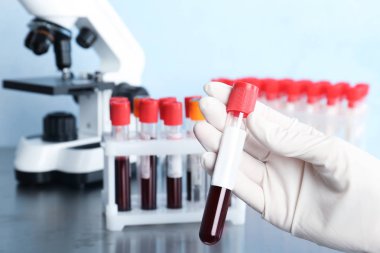 Cam tüp kan ile laboratuvar, closeup tutan doktor. Alerji testi