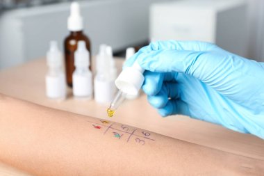 Doktor yapma alerji testi masada, portre