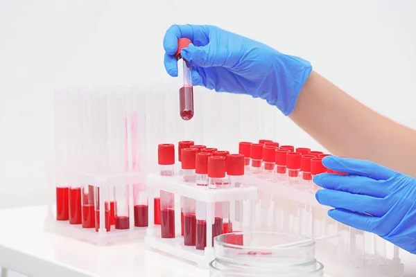 Científico Trabajando Con Muestras Sangre Tubos Ensayo Mesa — Foto de Stock