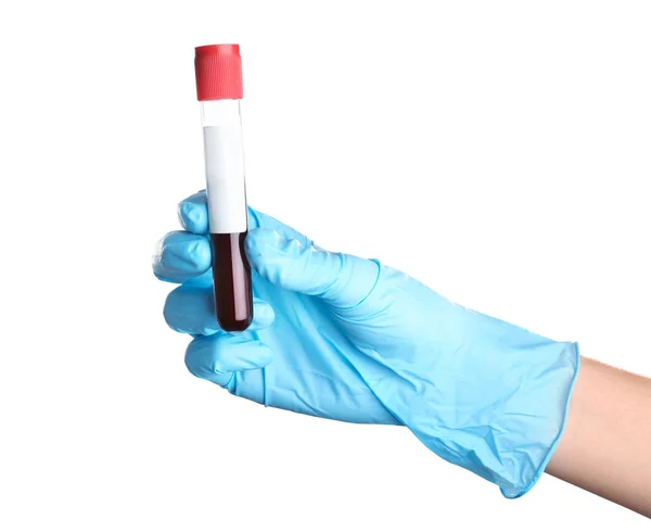 Arzt Hält Glasröhre Mit Blut Auf Weißem Hintergrund Nahaufnahme Allergietest — Stockfoto