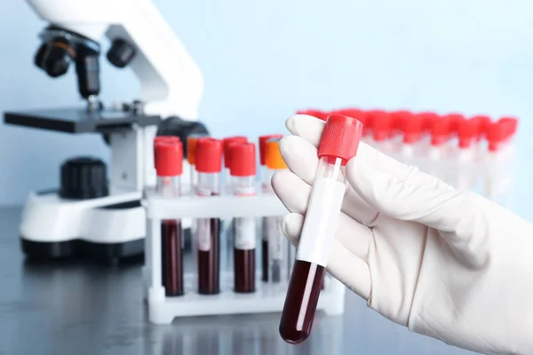 Orvos Gazdaság Üvegcső Vérrel Laboratóriumban Közelkép Allergia Vizsgálat — Stock Fotó