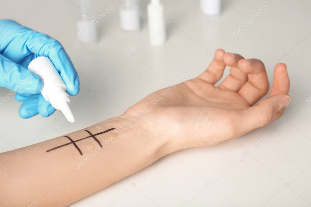 Doctor making allergy test at table, closeup
