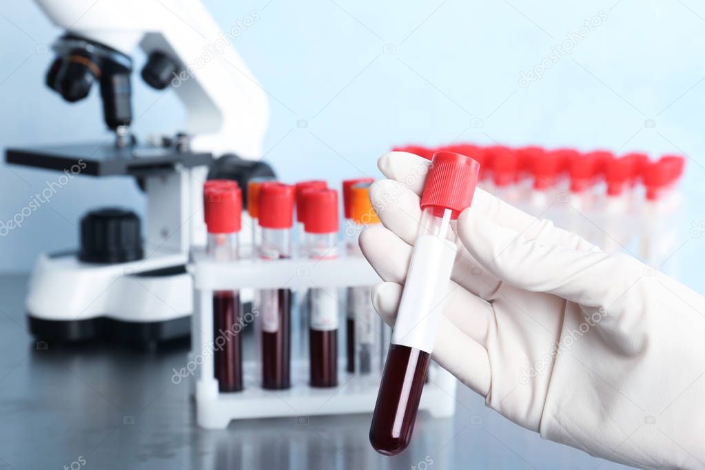 Doctor holding glass tube with blood in laboratory, closeup. Allergy test