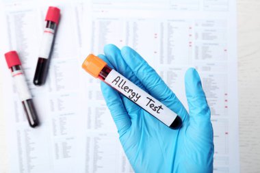 Cam tüp kan ile masa üzerinde üstten görünüm tutan doktor. Alerji testi