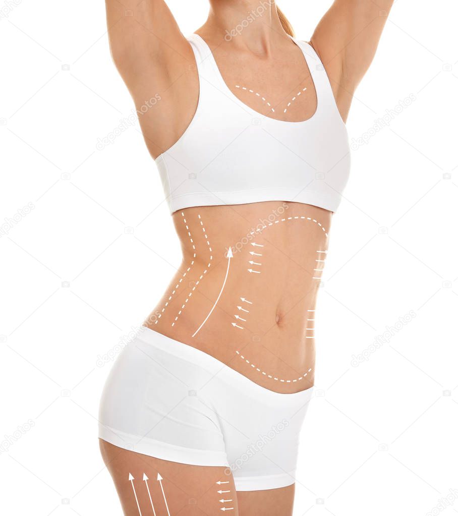Young woman with marks for liposuction operation on white background. Cosmetic surgery