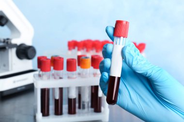 Cam tüp kan ile laboratuvar, closeup tutan doktor. Alerji testi