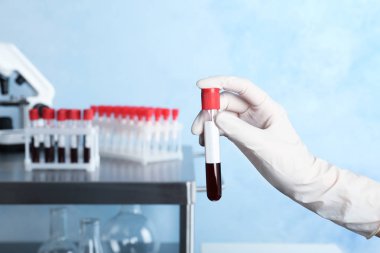Cam tüp kan ile laboratuvar, closeup tutan doktor. Alerji testi