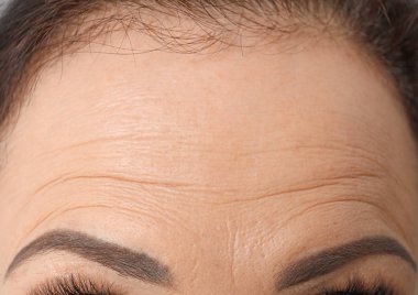 Güzel yaşlı kadın, closeup alın