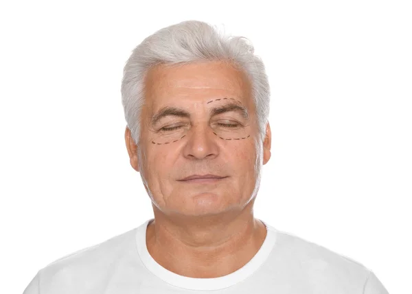 白い背景に 美容整形手術のための準備の顔マークで年配の男性の肖像画 — ストック写真