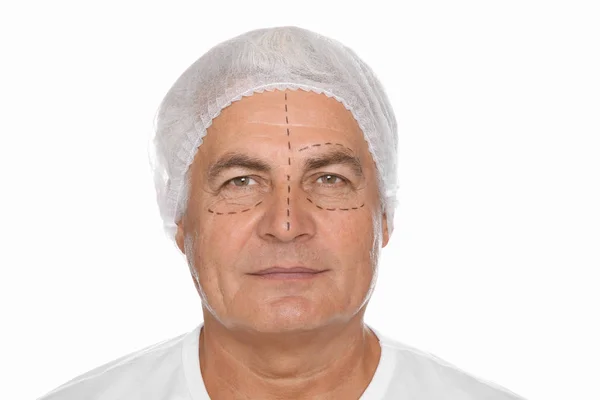 Potret Laki Laki Senior Dengan Tanda Wajah Mempersiapkan Operasi Kosmetik — Stok Foto