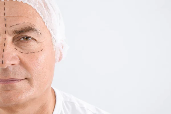 Pria Senior Dengan Tanda Wajah Mempersiapkan Operasi Kosmetik Terhadap Latar — Stok Foto