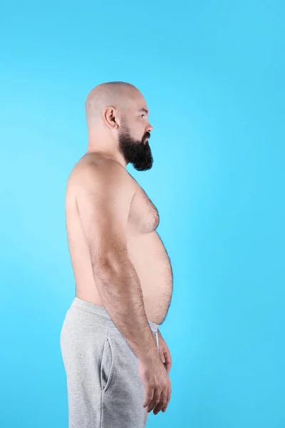 Kövér Ember Háttér Színét Fogyás — Stock Fotó