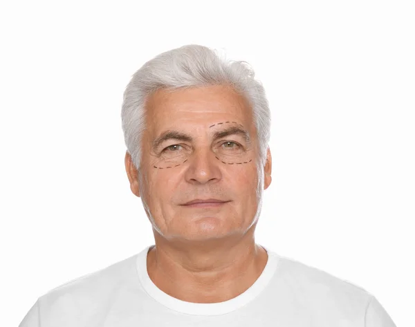 Portrait Senior Man Marks Face Preparing Cosmetic Surgery White Background — Stock Photo, Image