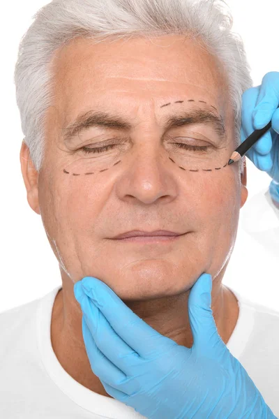 Doctor Marking Senior Man Face Cosmetic Surgery White Background — Stock Photo, Image