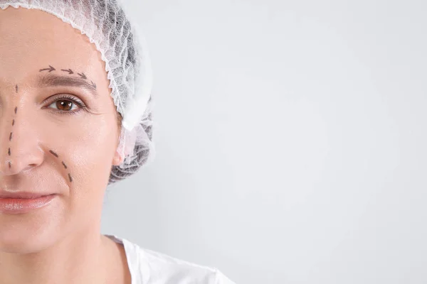 Mulher Madura Com Marcas Rosto Preparando Para Cirurgia Estética Contra — Fotografia de Stock