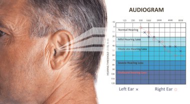 İşitme kaybı ve beyaz arka plan üzerinde audiogram belirtisi olan olgun adam. Tıbbi test