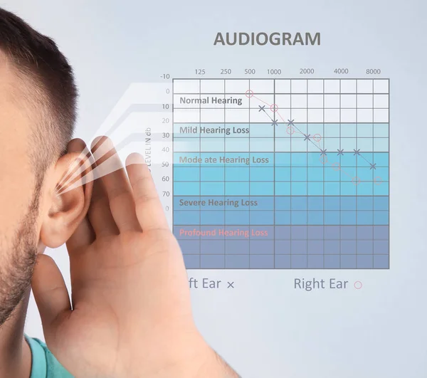 Mladý Muž Symptomem Ztráty Sluchu Audiogram Barvu Pozadí Zdravotní Test — Stock fotografie