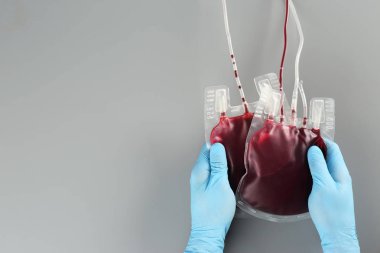 Gri arka plan, metin için yer ile üstten görünüm üzerinde kan paketleri elinde eldiven doktor. Bağış gün