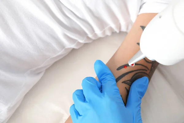 Γυναίκα Που Υποβάλλονται Διαδικασία Αφαίρεσης Τατουάζ Λέιζερ Στο Σαλόνι Κοντινό — Φωτογραφία Αρχείου