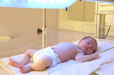 Yeni doğan çocuk hastanede ultraviyole ışık altında