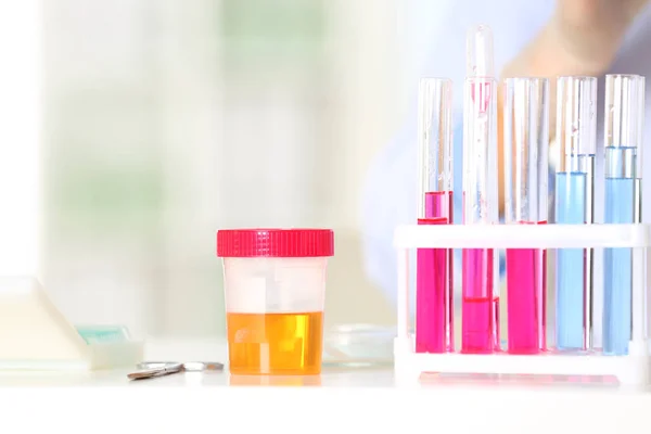 Rack Mit Reagenzgläsern Und Glas Auf Dem Tisch Labor Forschung — Stockfoto