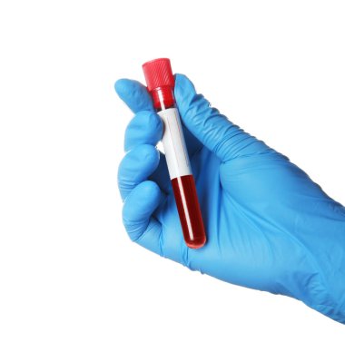 Tüp beyaz, closeup izole analiz için kan örneği ile tutarak laboratuar işçisi