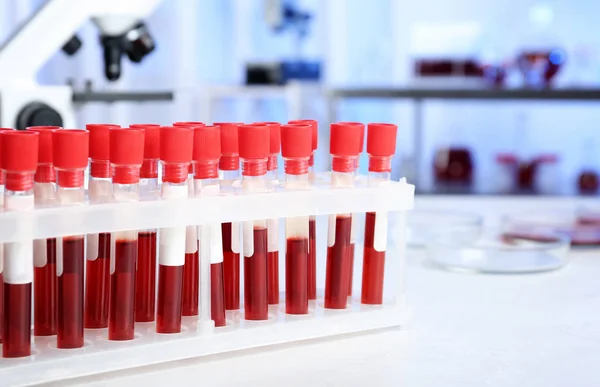Tubos Ensayo Con Muestras Sangre Para Análisis Mesa Del Laboratorio —  Fotos de Stock