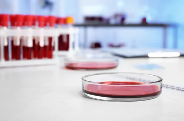 Cawan Petri Dengan Sampel Darah Untuk Analisis Tabel Laboratorium — Stok Foto