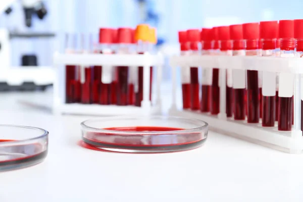 Tubos Ensayo Placas Petri Con Muestras Sangre Para Análisis Mesa — Foto de Stock