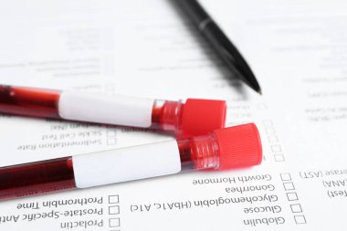 Test tüpleri ile laboratuvar analiz için kan örnekleri formu, closeup sınama