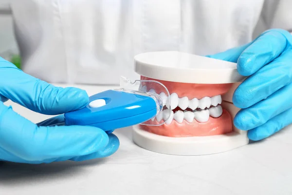 Dentista Mostrando Como Usar Dispositivo Clareamento Dos Dentes Com Modelo — Fotografia de Stock