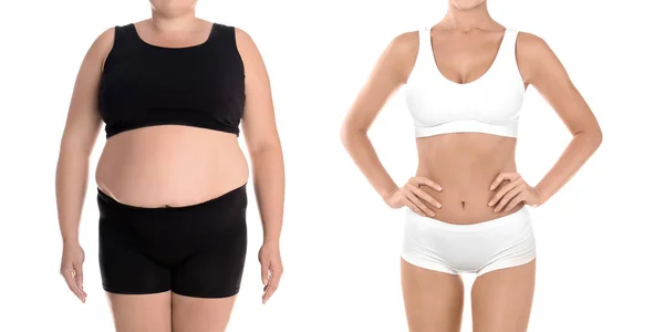 Junge Frau Vor Und Nach Gewichtsverlust Auf Weißem Hintergrund Nahaufnahme — Stockfoto
