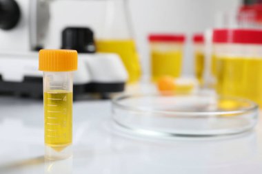 İdrar örneği laboratuvar, metin için yer tablo içeren kapsayıcı. Tıbbi analiz