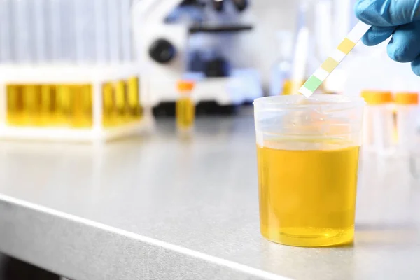 Laborantin Legt Lackmuspapier Urinprobe Auf Den Tisch Nahaufnahme Mit Platz — Stockfoto