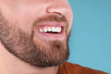Renk arka planda, closeup gülümseyen sağlıklı dişlere sahip genç adam