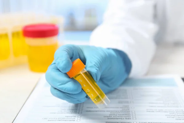 Laboratorium Medewerker Bedrijf Container Met Urine Ingewogen Analysemateriaal Aan Tafel — Stockfoto