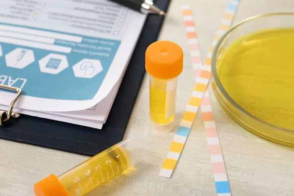 Containers Met Urine Monster Voor Analyse Lakmoespapier Medisch Rapport Tafel — Stockfoto