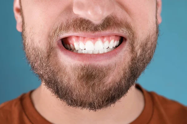 Giovane Uomo Con Denti Sani Sorridente Sfondo Colore Primo Piano — Foto Stock