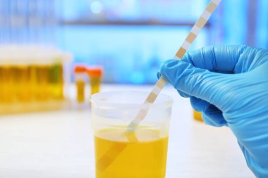 Laboratuar asistanı ile idrar örneği ve tablo, closeup turnusol kağıdı analiz yapıyor